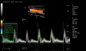 3D / 4D Цветная доплеровская ультразвуковая система Кардиологическая ультразвуковая тележка Ультразвуковая диагностическая система Медицинские Ультразвуковые инструменты Изображение 2